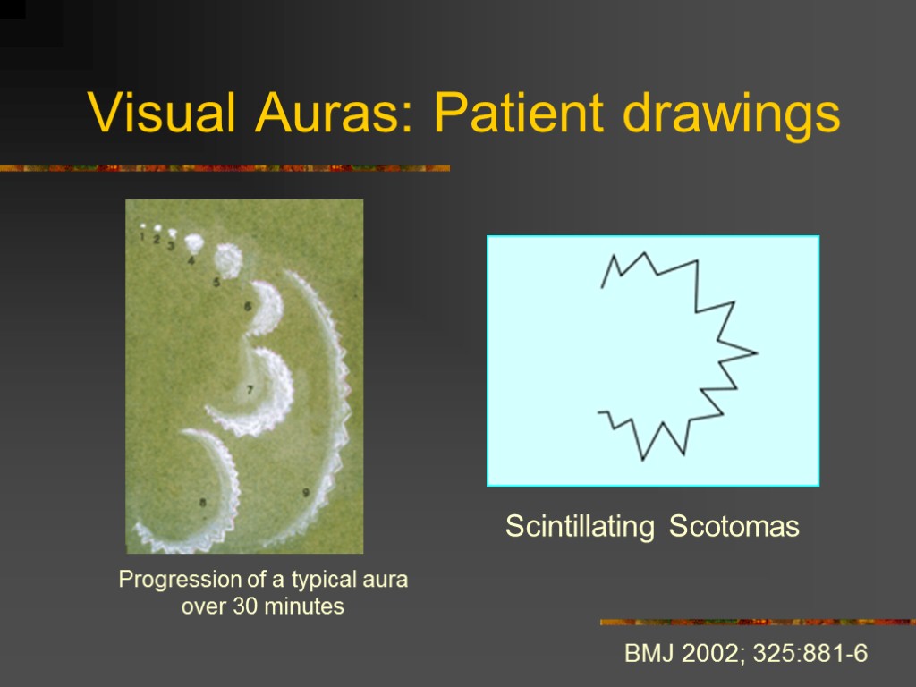 Visual Auras: Patient drawings Scintillating Scotomas Progression of a typical aura over 30 minutes